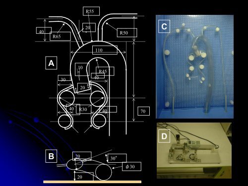 The Physics of Guiding Catheter