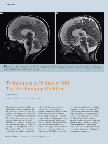 Techniques in Pediatric MRI – Tips for Imaging Children - Siemens ...