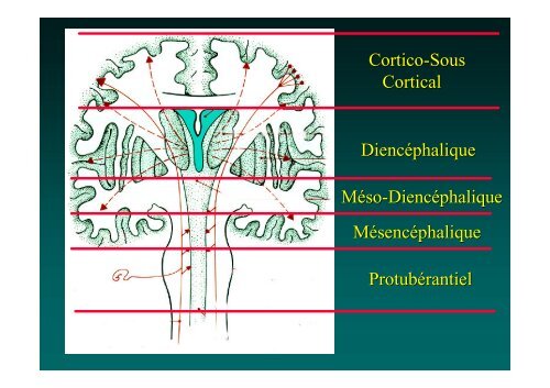 Examen Clinique et Surveillance d'un coma d'origine neurologique