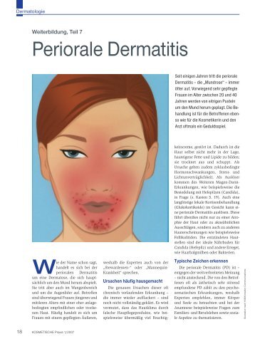 Weiterbildung, Teil 7 Periorale Dermatitis - Beauty Forum