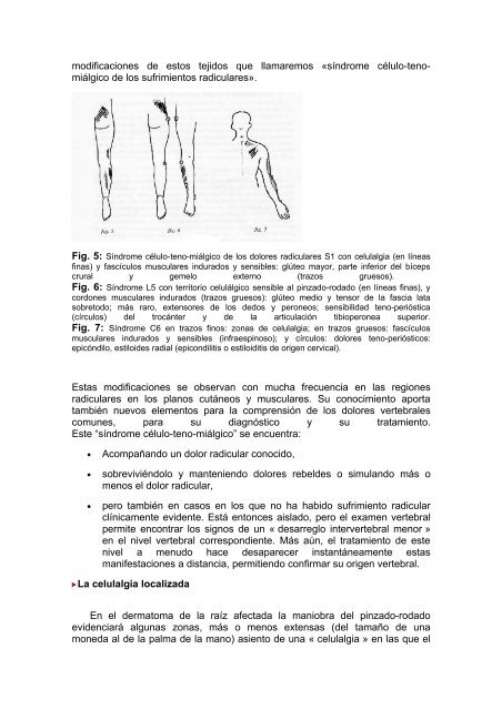 DiagnÃ³stico y mecanismo de un desarreglo intervertebral ... - sofmmoo