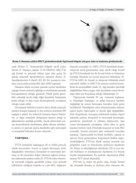 Frontotemporal Demans: Bir Olgu Sunumu - DÃ¼ÅÃ¼nen Adam ...