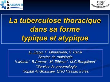 La tuberculose thoracique dans sa forme typique et atypique