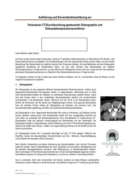 Aufklärung fü eine Dekompression oder Diskographie - Praxis für ...