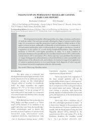 talon cusp on permanent maxillary canine: a rare case report - A4add