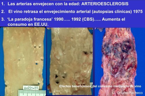 Efectos beneficiosos del consumo moderado de vino - Coag