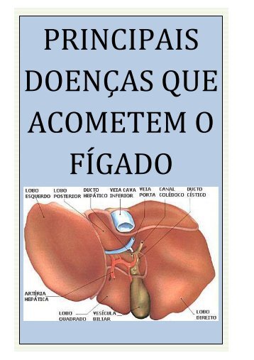 Principais doencas do figado - Arte do Cuidar