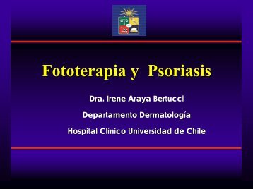 Fototerapia y Psoriasis