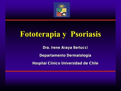 Fototerapia y Psoriasis
