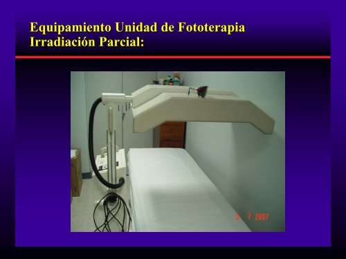 Fototerapia y Psoriasis