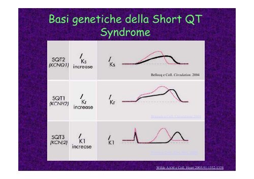 Un tratto a rischio. La sindrome del QT corto - Cuorediverona.it