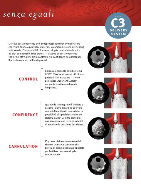 Repositioning - Gore Medical