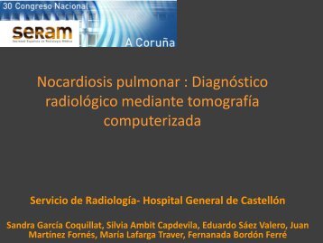 Nocardiosis pulmonar : Diagnóstico radiológico mediante ...