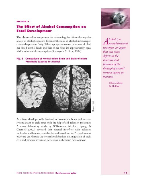 FETAL ALCOHOL SPECTRUM DISORDERS florida resource guide