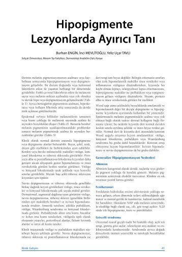 Hipopigmente Lezyonlarda AyÄ±rÄ±cÄ± TanÄ± - Klinik GeliÅim