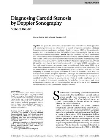 Diagnosing Carotid Stenosis by Doppler Sonography