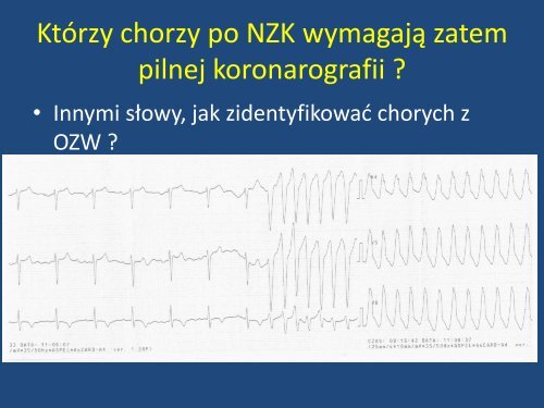 NZK i PCI - 10 lat doÅwiadczeÅ oraz kryteria przyjmowania ...