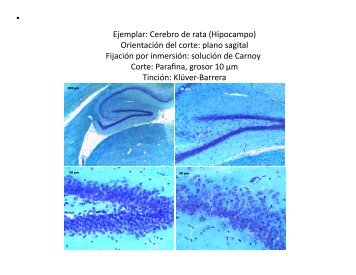 Fijación por Inmersión