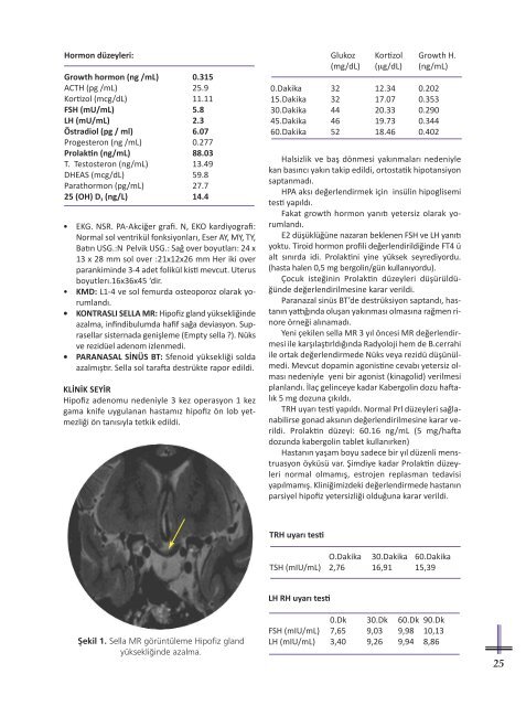 2012 Endokrin Vakalar KitabÄ± - TÃ¼rkiye Endokrinoloji Metabolizma ...