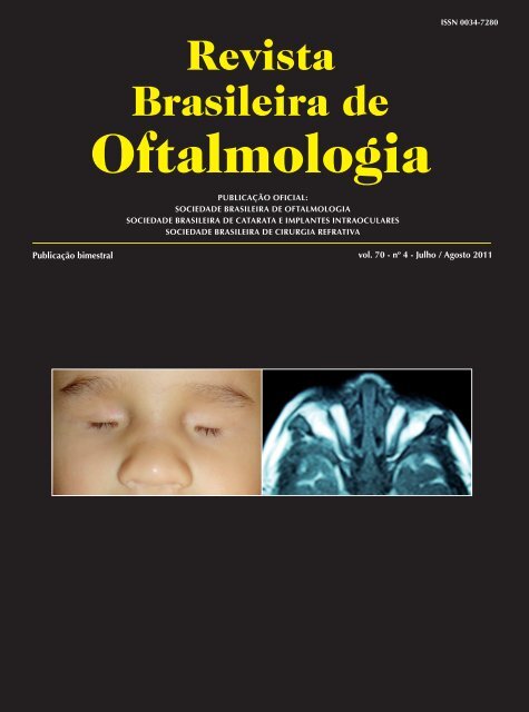 Jul-Ago - Sociedade Brasileira de Oftalmologia