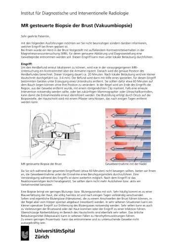 MR gesteuerte Biopsie der Brust (Vakuumbiopsie) - Radiologie