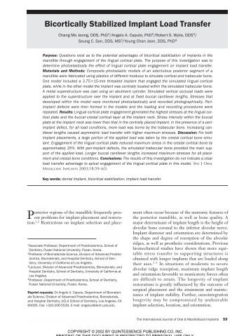 Bicortically Stabilized Implant Load Transfer