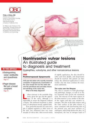 Noninvasive vulvar lesions An illustrated guide to ... - Urogyn.org