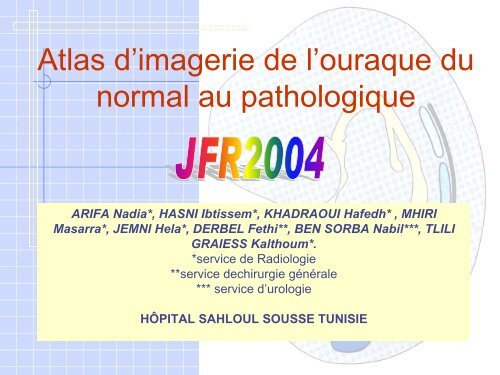 Le kyste de l'ouraque