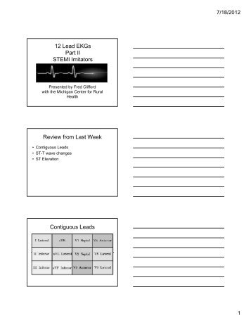 12 Lead EKGs Part II STEMI Imitators Review from Last Week ...