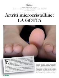 Artriti microcristalline: LA GOTTA - CNA Pensionati