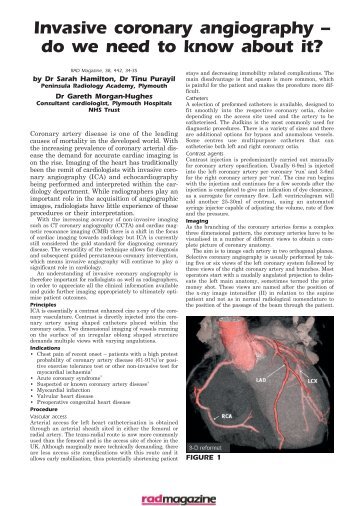 Invasive coronary angiography â do we need to ... - RAD Magazine