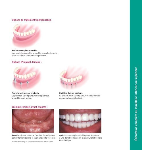 Education des patients - Zimmer Dental