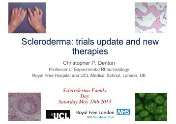 Prof Chris Denton - scleroderma-royalfree.org.uk