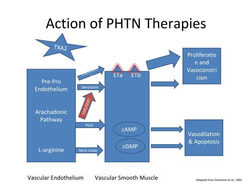 Pulmonary Hypertension: Beyond the Swan Ganz Catheter