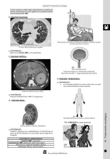 OncologÃ­a - Curso Intensivo MIR Asturias