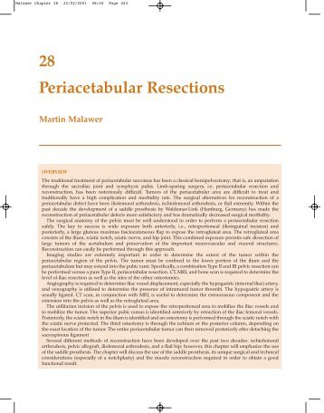 28 Periacetabular Resections - Sarcoma.org