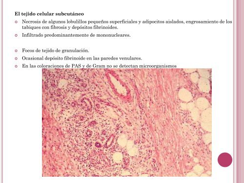 Dermatosis neutrofÃ­licas