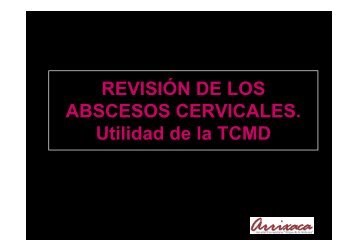 REVISIÓN DE LOS ABSCESOS CERVICALES. Utilidad de la TCMD