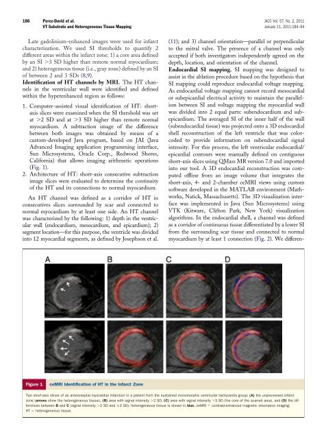 Noninvasive Identification of Ventricular Tachycardia ... - DIE - UPM