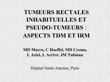 aspects tdm et irm