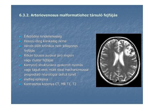 Laboratóriumi és képalkotó vizsgálatok szerepe a fejfájások ...