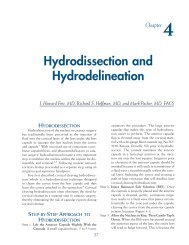 Hydrodissection and Hydrodelineation