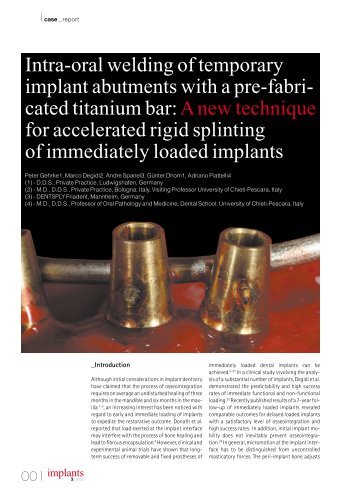 Intra-oral welding of temporary implant abutments with a pre-fabri ...
