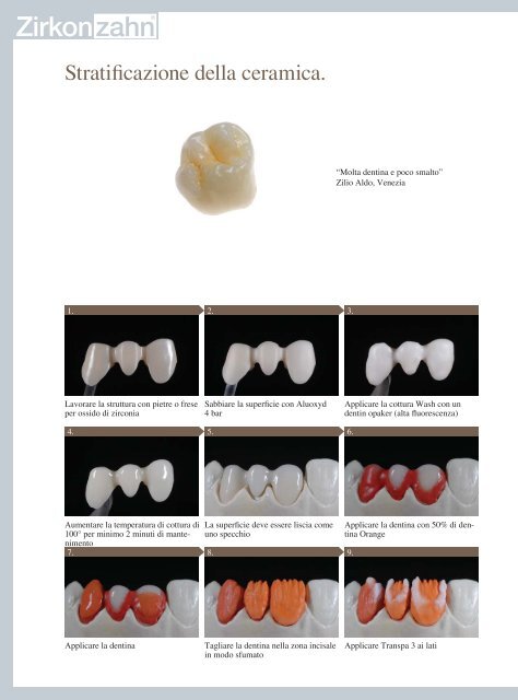 tecnologia di fresatura della zirconia - Zirkonzahn