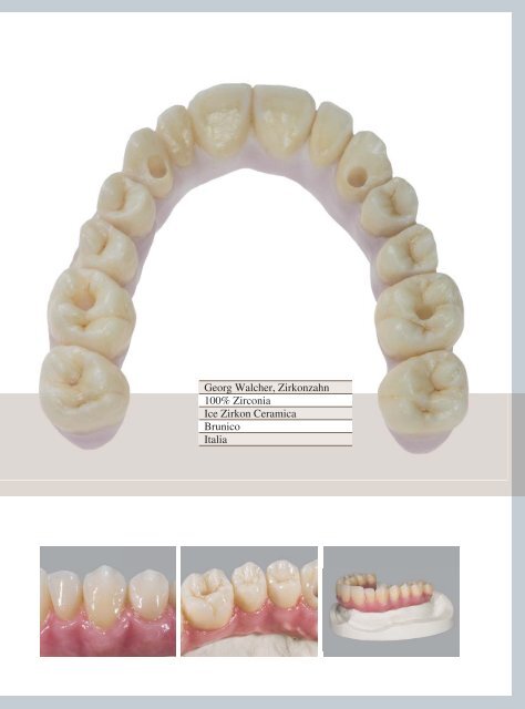 tecnologia di fresatura della zirconia - Zirkonzahn