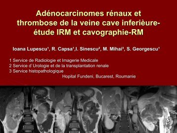 AdÃ©nocarcinomes rÃ©naux et thrombose de la veine cave inferiÃ¨ure ...