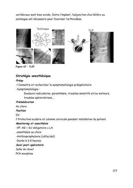 Neurochirurgie - virtanes