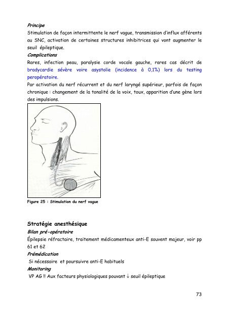 Neurochirurgie - virtanes