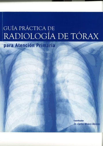 guiaPracticaRadiologiaTorax