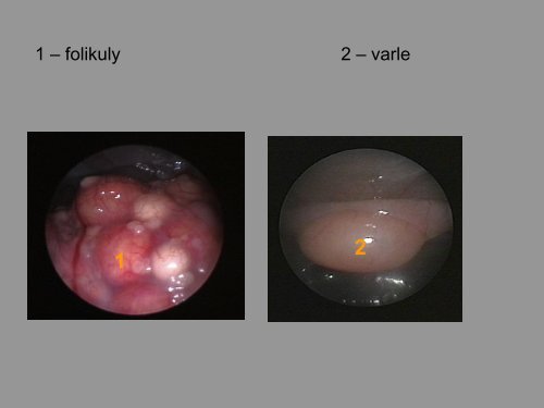 KLINICKÃ MORFOLOGIE - PLAZI